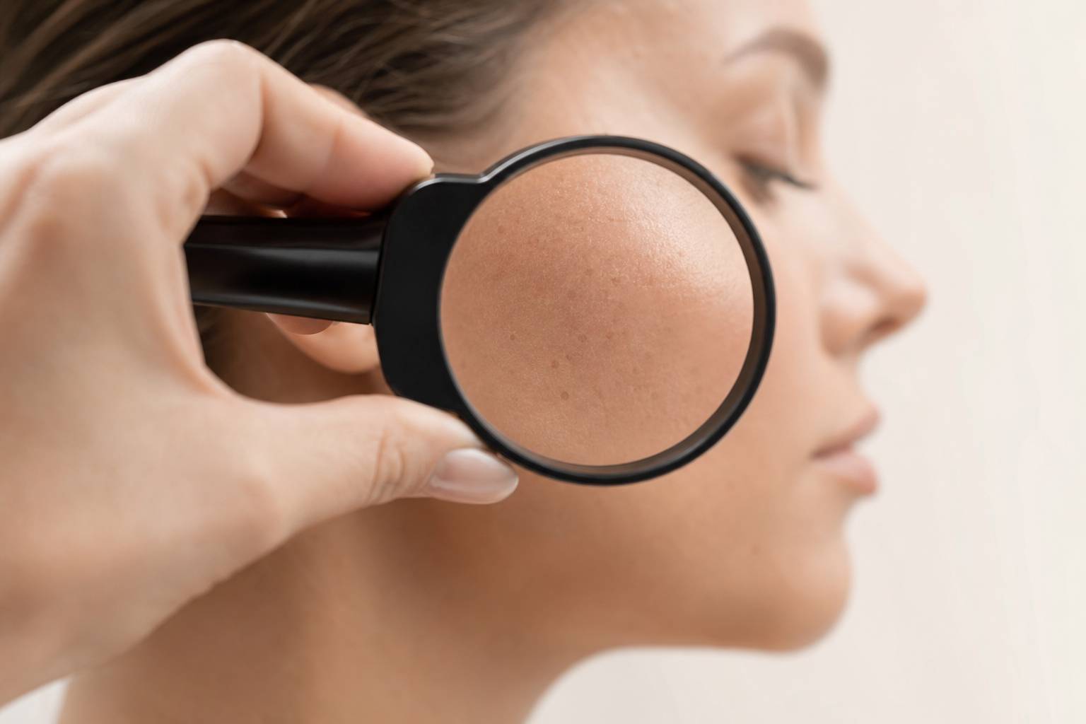 Consultation dermatologique pour diagnostiquer les microkystes du visage à la loupe